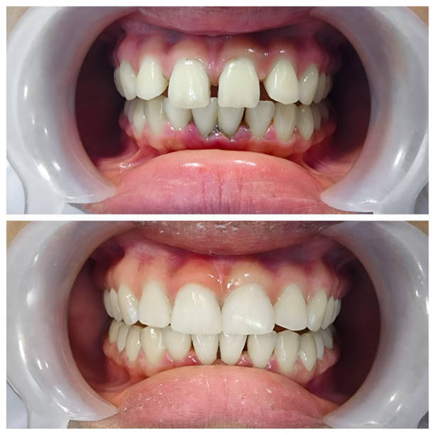 TMJ/TMD Treatment